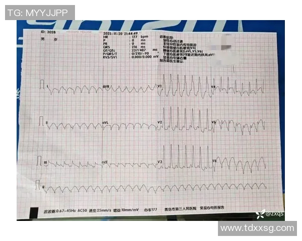 巴媒：奥斯卡此前并无严峻心脏问题病史，医师正查询反常原因